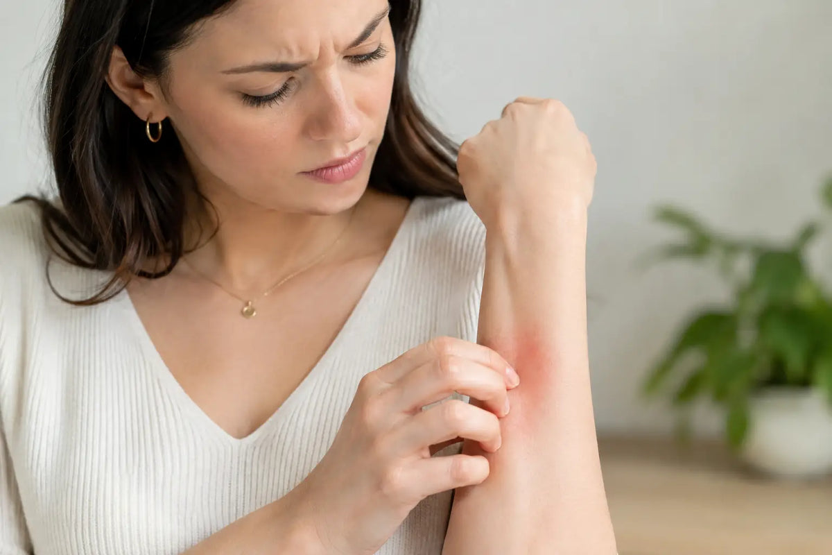 Jewellery Allergy Symptoms and What to Do