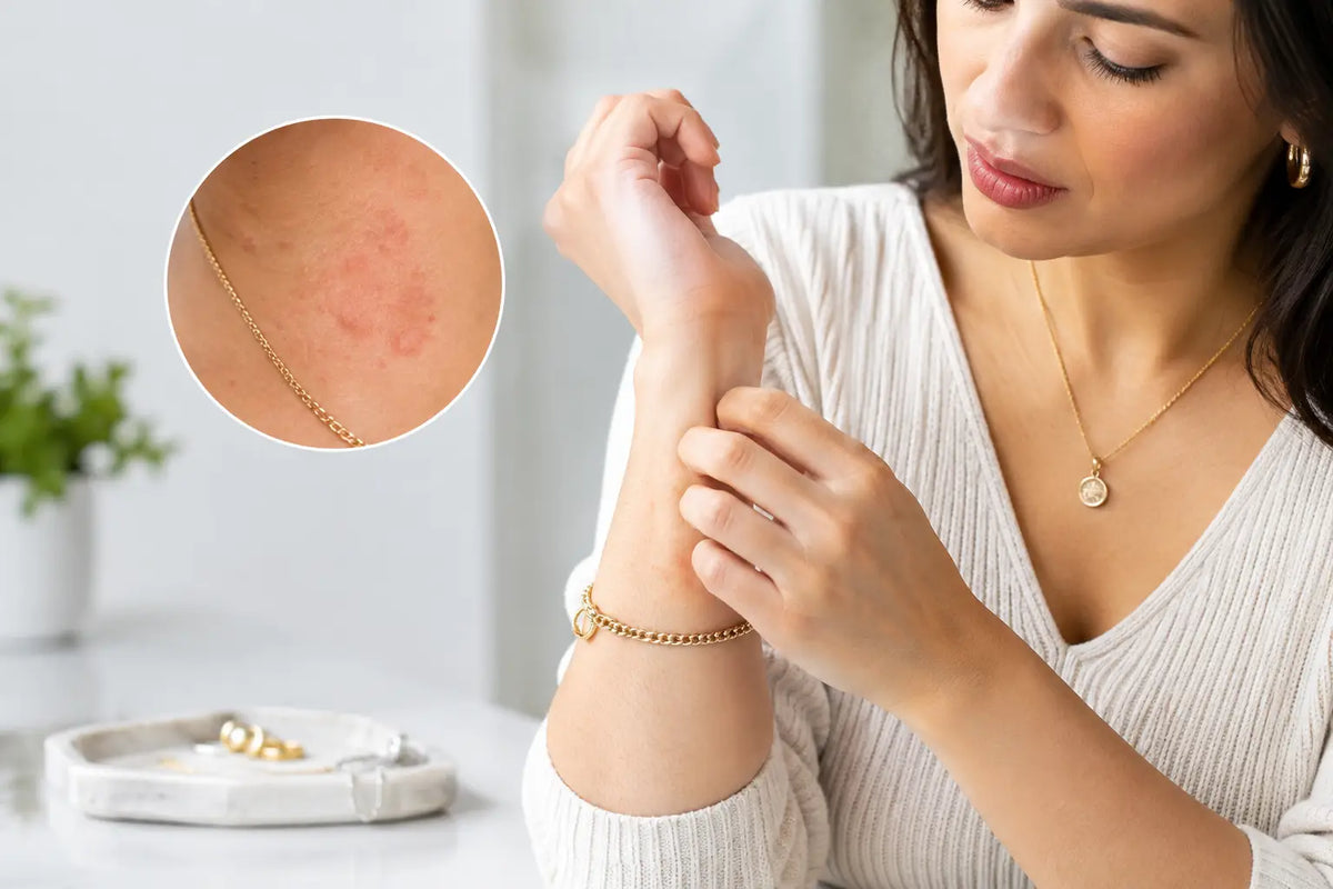 Can Jewellery Cause Skin Rashes? Causes and Care